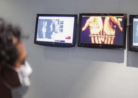 عدم مشاهده ابتلا به آبله میمون در هرمزگان/ باتوجه به شناسایی بیماری در یکی از کشورهای حاشیه خلیج فارس، هرمزگانی ها احتیاط کنند