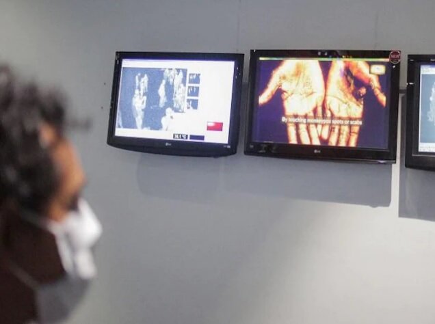 عدم مشاهده ابتلا به آبله میمون در هرمزگان/ باتوجه به شناسایی بیماری در یکی از کشورهای حاشیه خلیج فارس، هرمزگانی ها احتیاط کنند