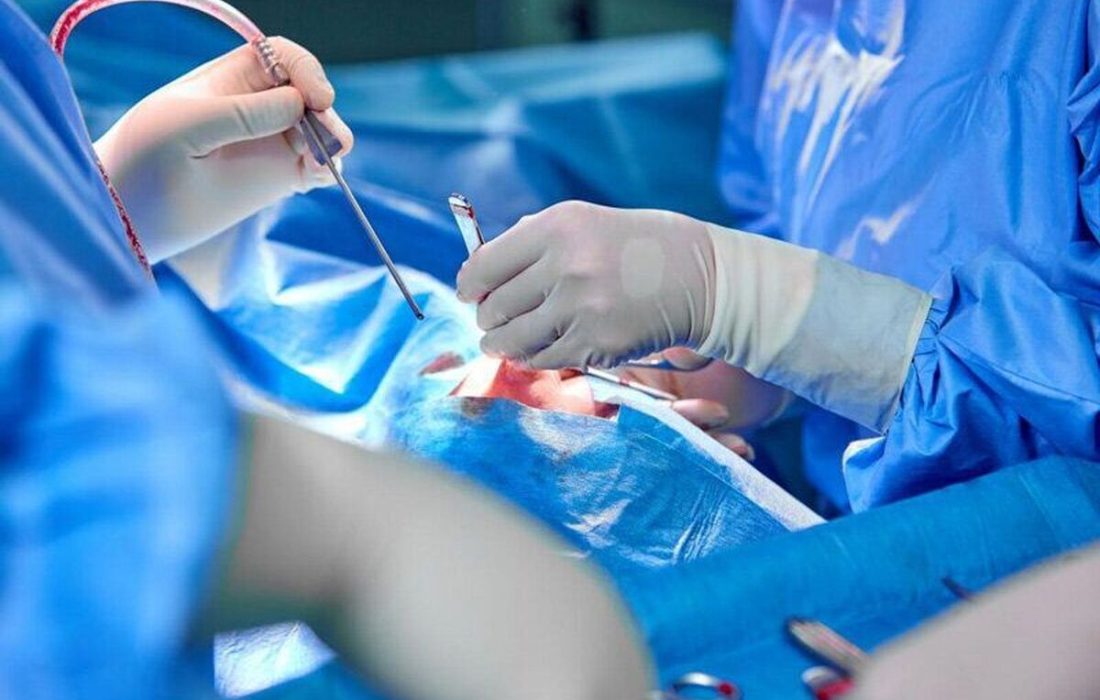 عمل خارج کردن قیچی از جمجمه پسر بچه بستکی با موفقیت انجام شد